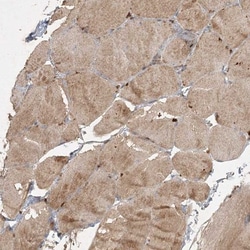 KBTBD4 Antibody, Novus Biologicals:Antibodies:Primary Antibodies